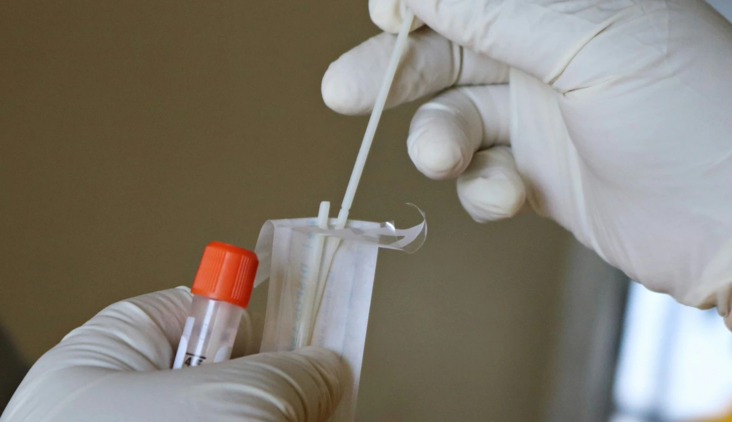Obliba genetického testování v Česku roste. Odborníci varují před riziky
