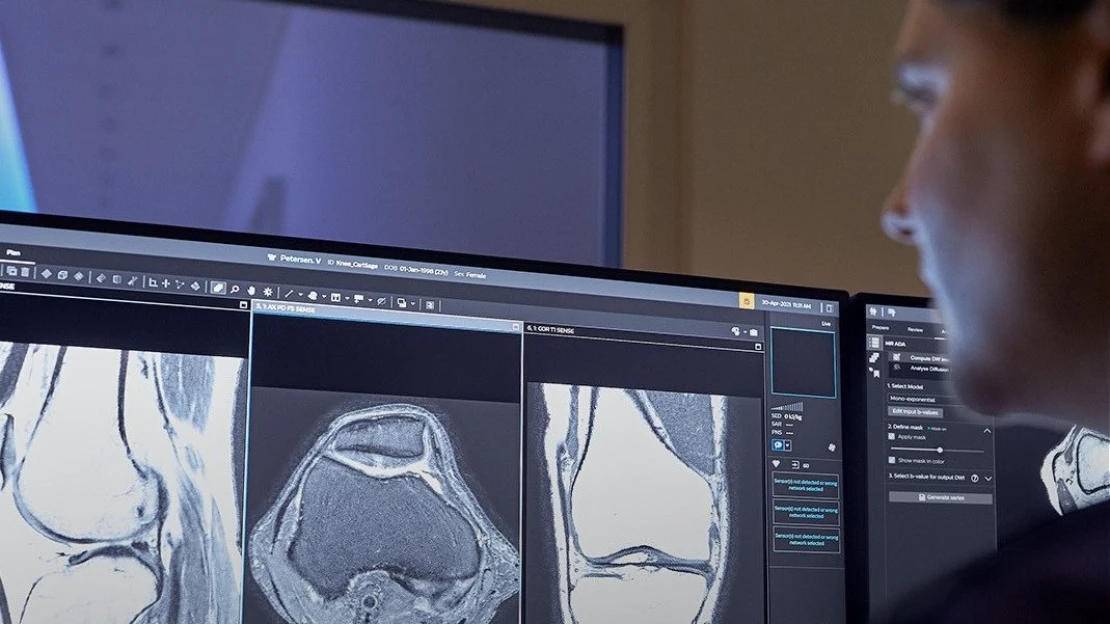 Umělá inteligence odhalí i to, co oko nevidí. Pomáhá tak dříve detekovat nádory