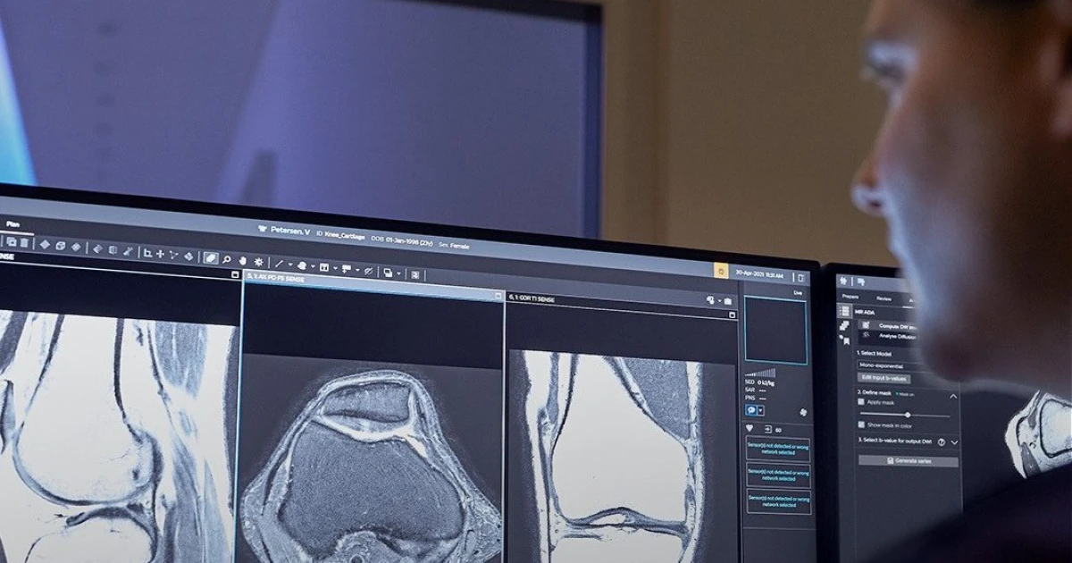 Umělá inteligence odhalí i to, co oko nevidí. Pomáhá tak dříve detekovat nádory